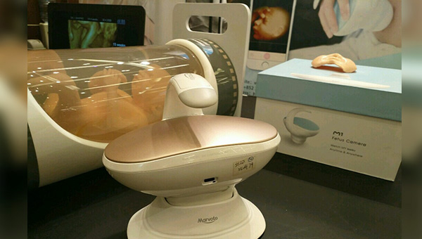 胎兒相機 胎兒相機