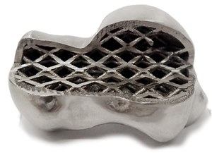 bone replacement bone replacement